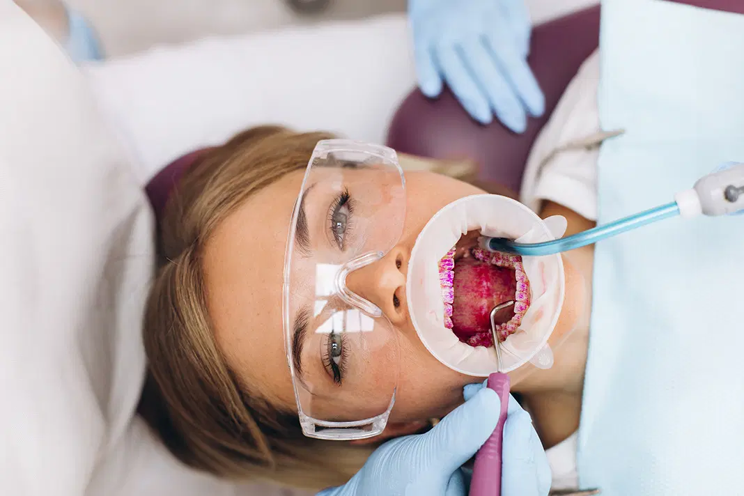The Benefits of Guided Biofilm Therapy (GBT) for Sensitive Teeth