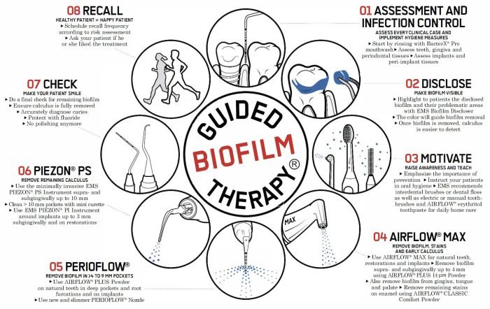 What Is Guided Biofilm Therapy (GBT) - golden dental clinic